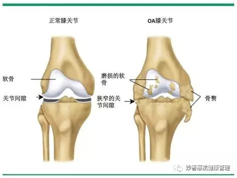 間充質幹細胞治療膝關節軟骨損傷 Itw01